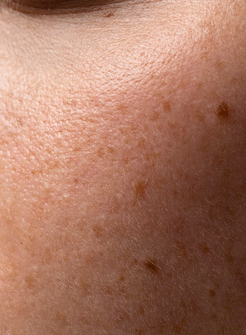 Textura de pele